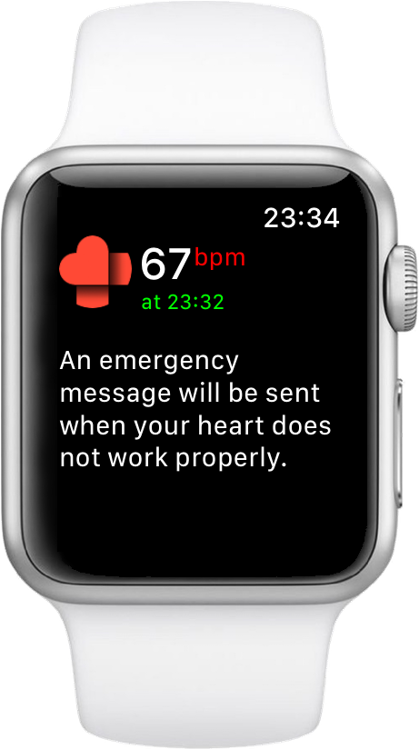 Heart Rate Monitoring - Low Heart Rate Apple Watch (478x840), Png Download