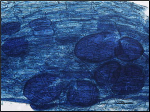 Vesicles In The Roots Of “vanda” Sweet Cherry Trees - Root Staining Fungal Pathogens (902x372), Png Download