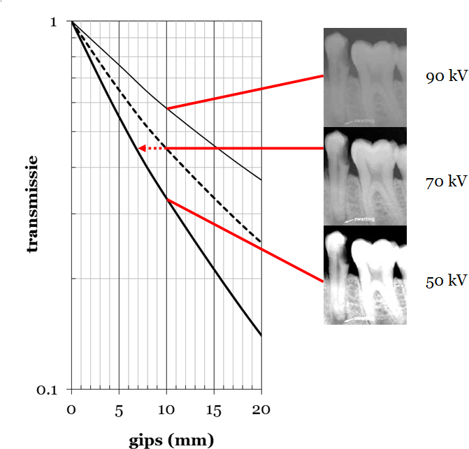 Transmission Through Plaster For Different Values Of - Groningen (725x657), Png Download