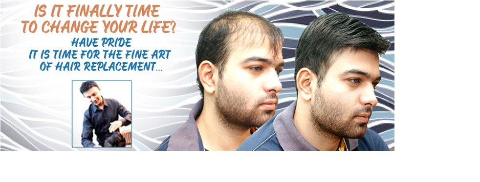 Your New Unit Will Be Shaped And Sized To Match Your - Hair Replacement For Men In Kuala Lumpur (1140x445), Png Download