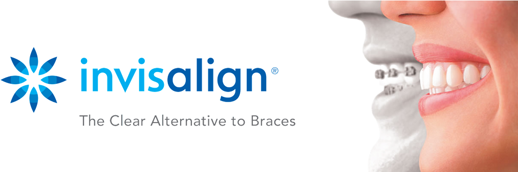 Invisalign® Takes A Modern Approach To Straightening - Invisalign The Clear Alternative To Braces (1145x336), Png Download