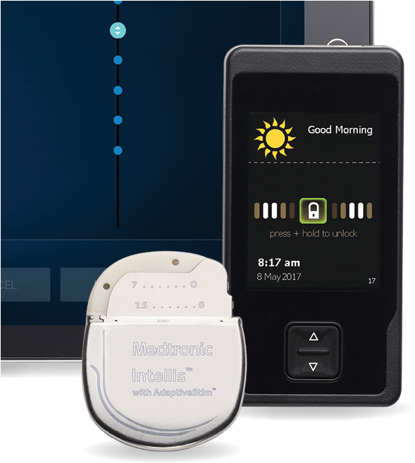 Medtronic Announces Fda Approval And U - Medtronics Spinal Cord Stimulator (654x717), Png Download
