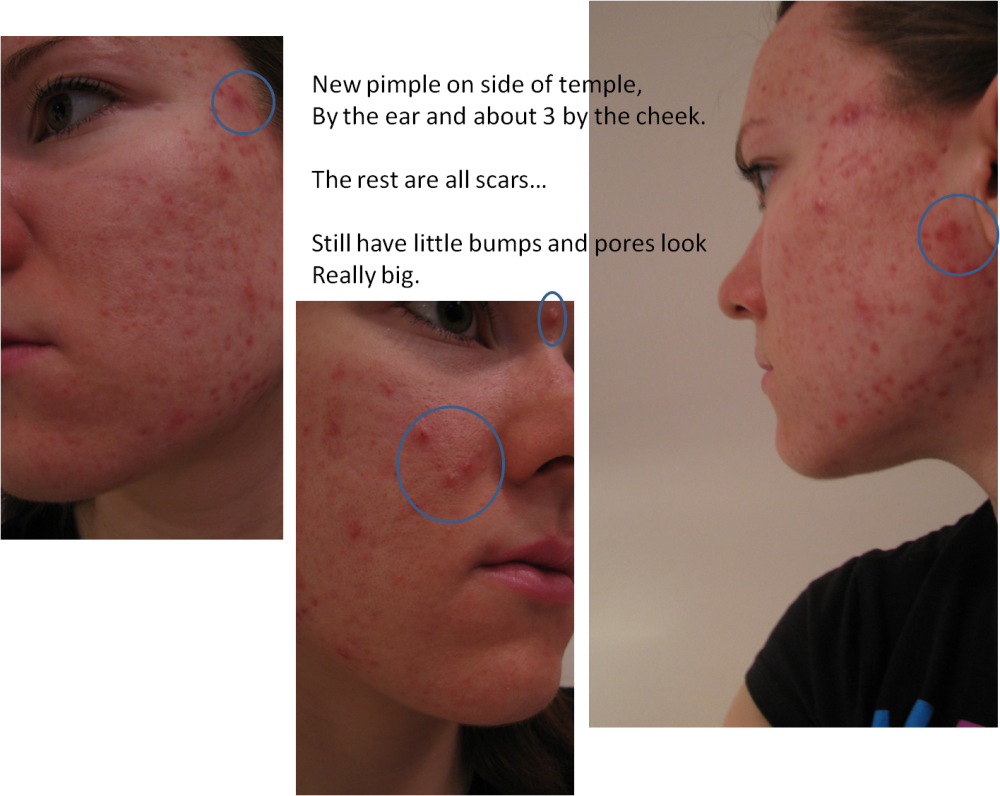 Picture12 - Freckle (1000x796), Png Download