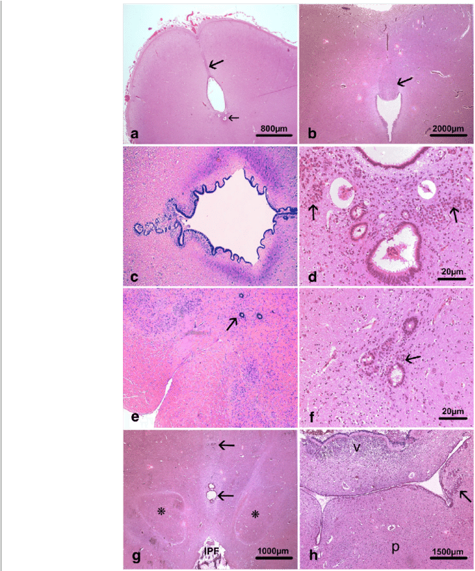 Main Histological Lesions Consisted In Hypoplasia Of - Illustration (850x821), Png Download