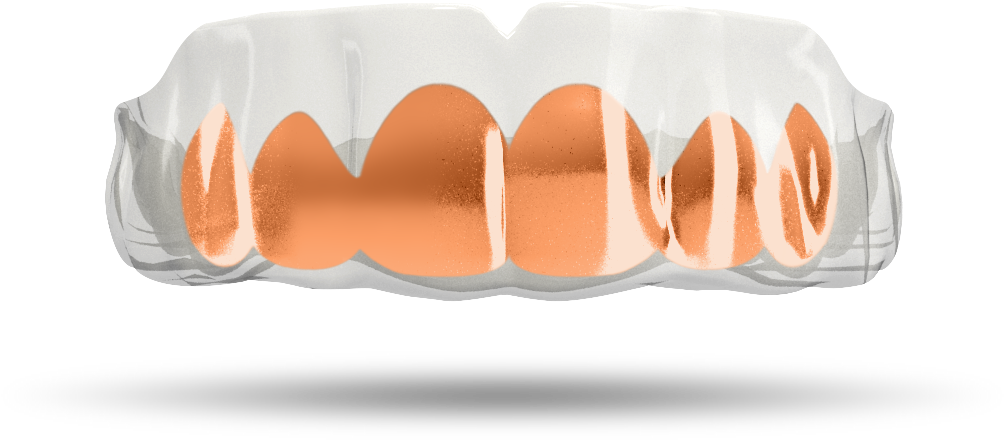 Chrome Rose Gold Grill - Gold Grill Transparent (1024x684), Png Download