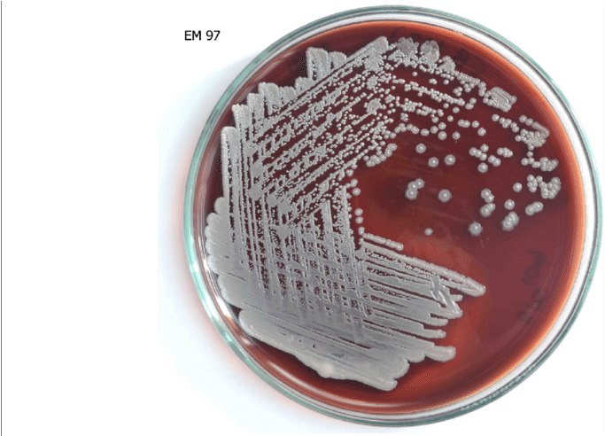 Pseudomallei Cultured In Blood Agar - Juice (850x491), Png Download