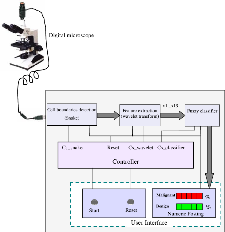 Interface Of Global Circuit Of Breast Cancer Diagnosis - Breast Cancer (732x757), Png Download
