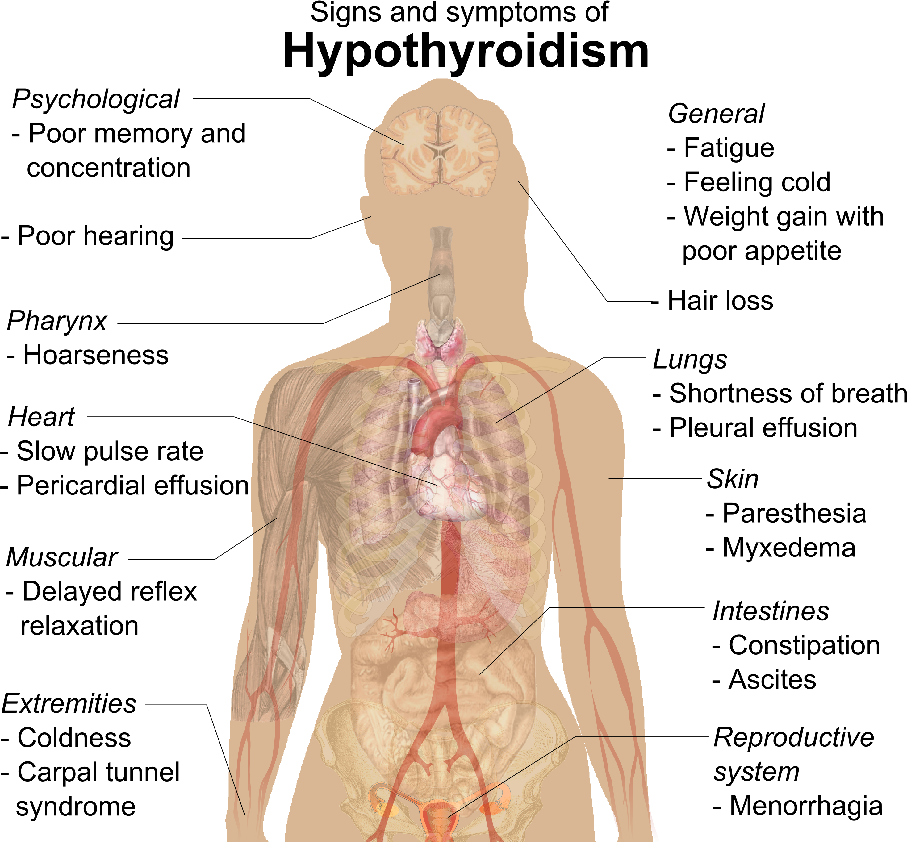 Signs And Symptoms O - Signs And Symptoms Of Hypothyroidism (1131x1024), Png Download