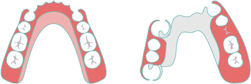 Partial Denture Sudbury Smiles - Greater Sudbury (1000x316), Png Download