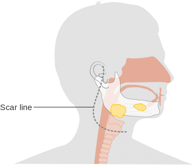 It Is The Most Common Cause That Results In It In The - Illustration (700x631), Png Download