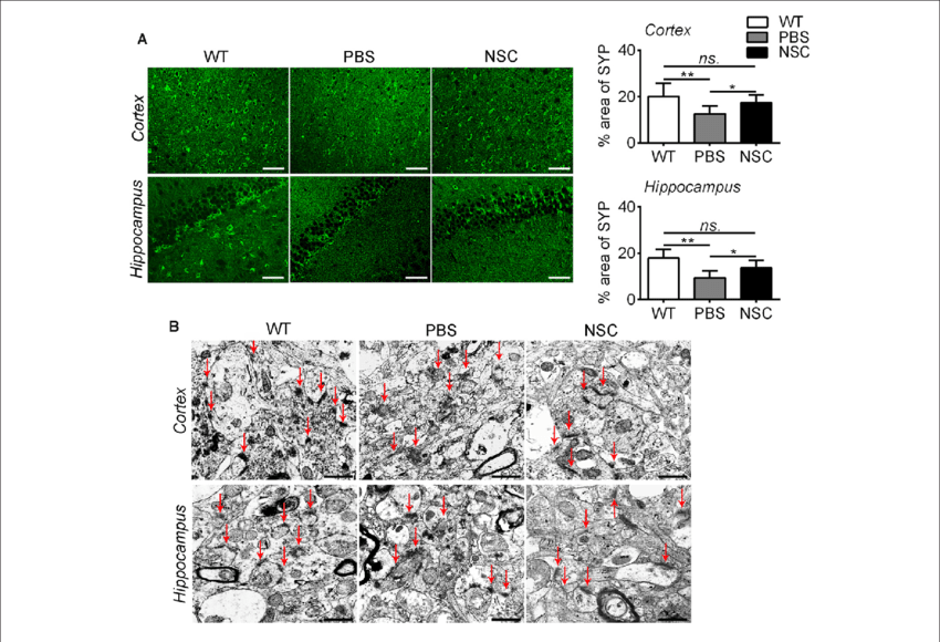 Syp Staining Sections In The Brains Of Pbs, Nsc Group - Grass (850x580), Png Download