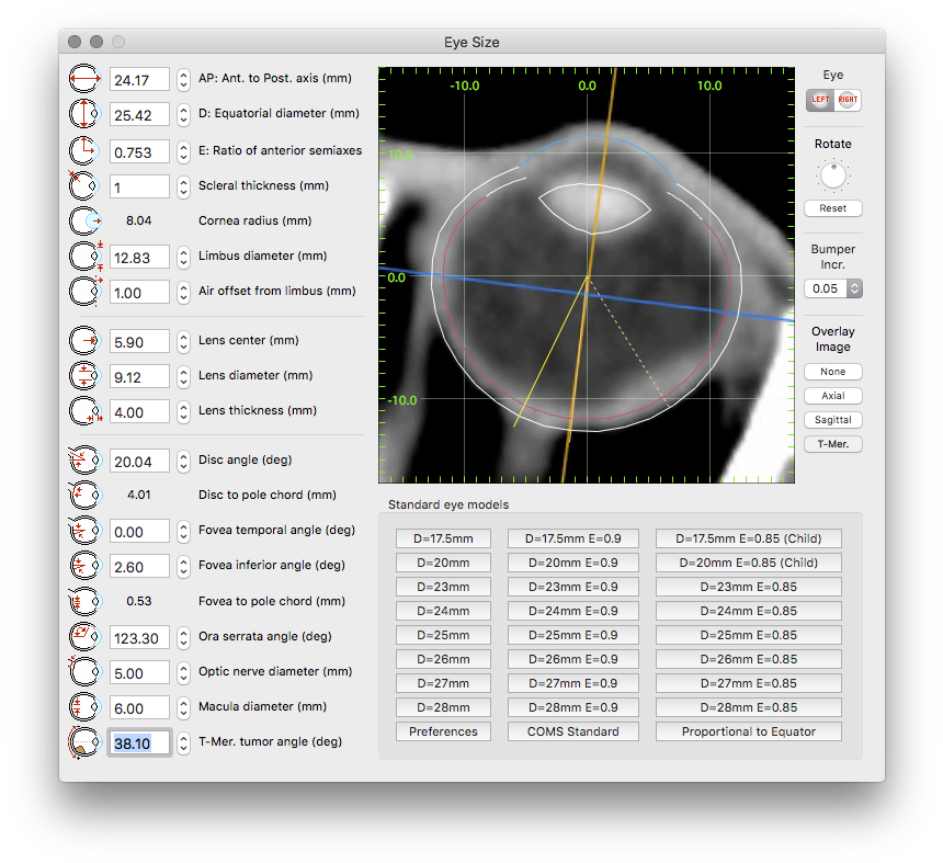 The Beige Colored Apex Control Handle Of The Image - Circle (865x798), Png Download