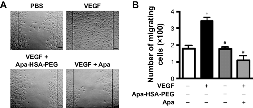Apa Hsa Peg Nanoparticles Inhibit Vegf Induced Wounding - Cat Liver (850x365), Png Download