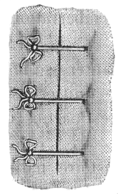 Types Of Stitches Used In Sutures, From Dictionnaire - Monochrome (450x735), Png Download