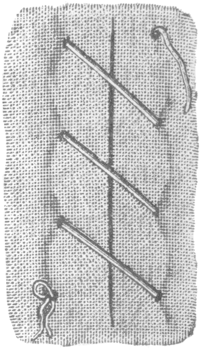 Types Of Stitches Used In Sutures, From Dictionnaire - Types Of Sutures (412x704), Png Download