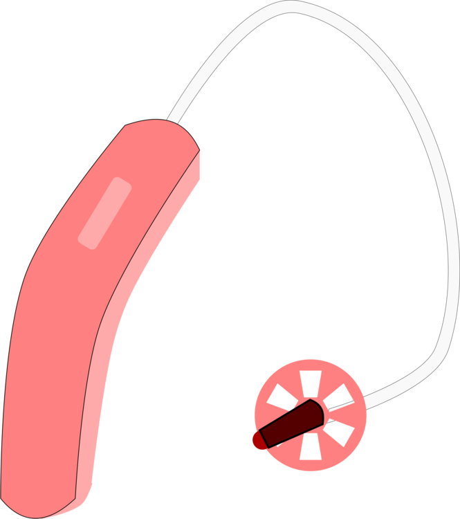 Hearing Aid Hearing Loss Hearing Test Deafness - Hearing Loss (665x750), Png Download