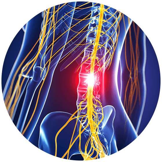 Real Patients - Pacientes Con Lesion Medular (560x560), Png Download