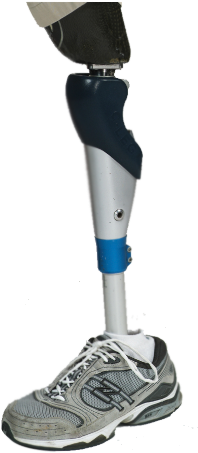 Prosthetics - Prosthetic Leg Png (421x941), Png Download