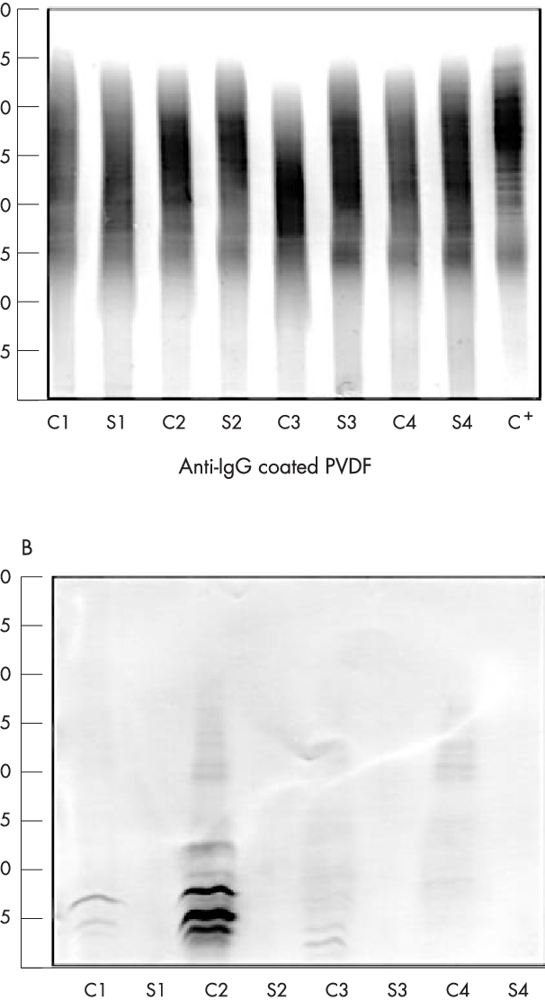 Immunoblots Of Igg And Of Free Kappa Bands (b) From - Monochrome (606x1111), Png Download