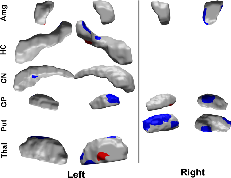 Adhd Just Image Base - Elbow Pad (1000x789), Png Download