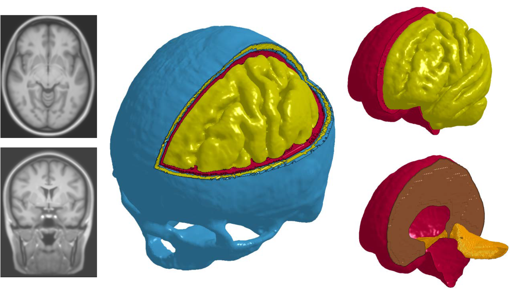 This Project Will Adapt A State Of The Art Head Model - Medical Imaging (1806x1024), Png Download