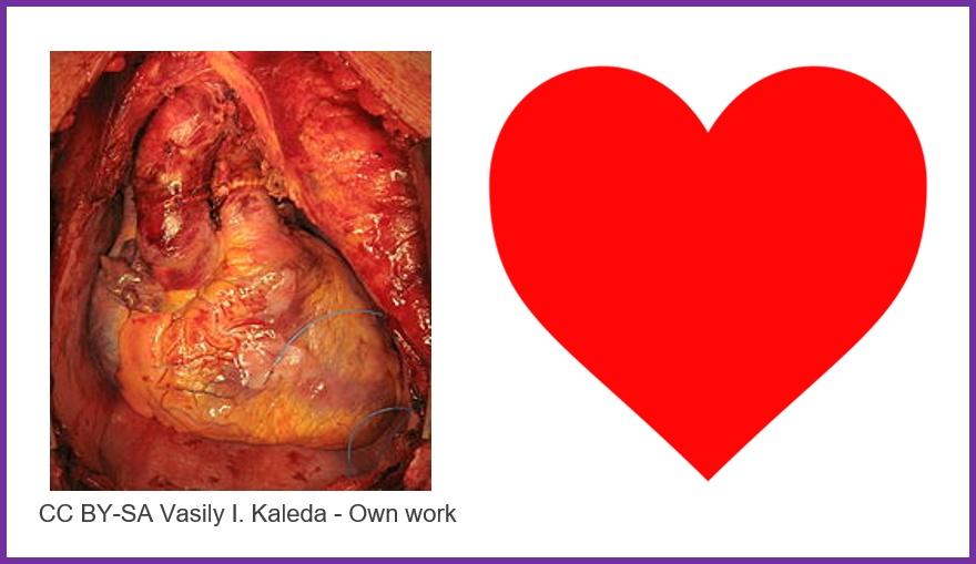 The Heart Is A Muscular Organ, Working Constantly To - Does A Heart Look Like (880x509), Png Download