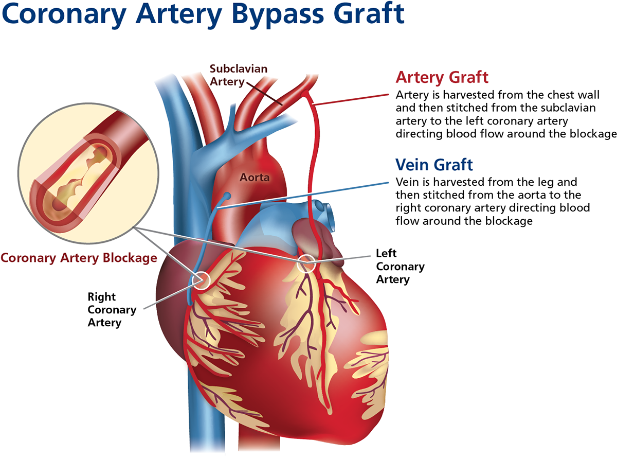 Sign Up To Join The Conversation - Diagram (1200x904), Png Download