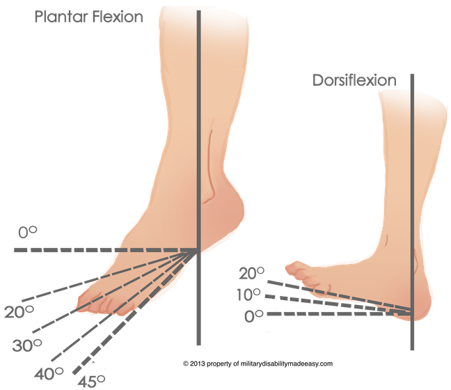 Pin Cam Walker Rom Boot Range Of Motion Cam Walker - Dorsal And Plantar (648x560), Png Download