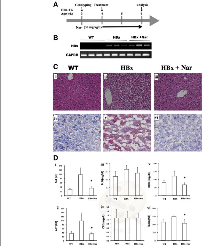 Treatment With Naringenin Reverses Fatty Liver And - Diagram (850x826), Png Download