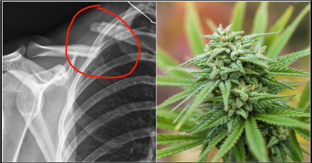 Who'd Of Thought That Smoking A Joint Could Be A Remedy - Marijuana Plants Up Close (1024x768), Png Download