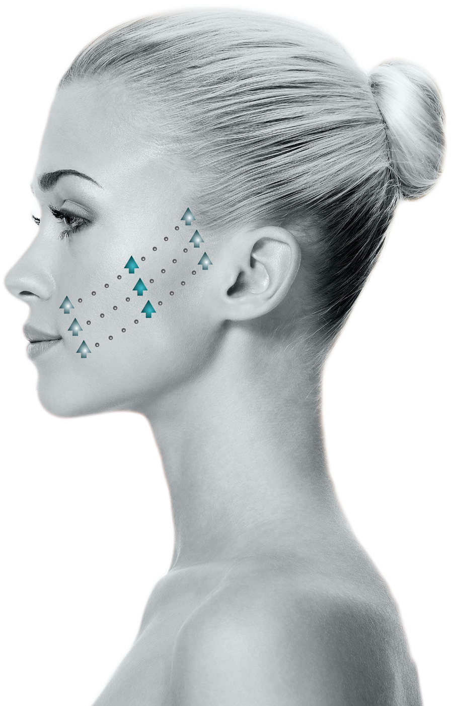 Silhouette Instalift - Silhouette Soft (1050x1500), Png Download