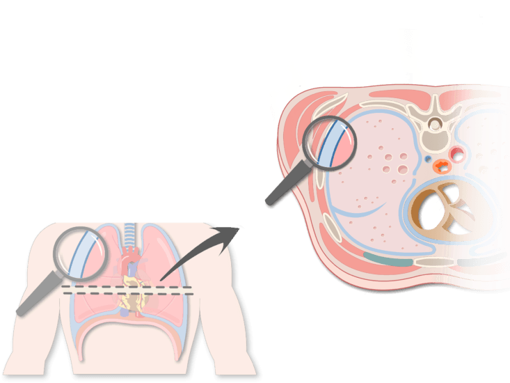An Expanded View Of The Thorax Magnifying The Pleura - Pleurae And Pleural Cavities (770x550), Png Download