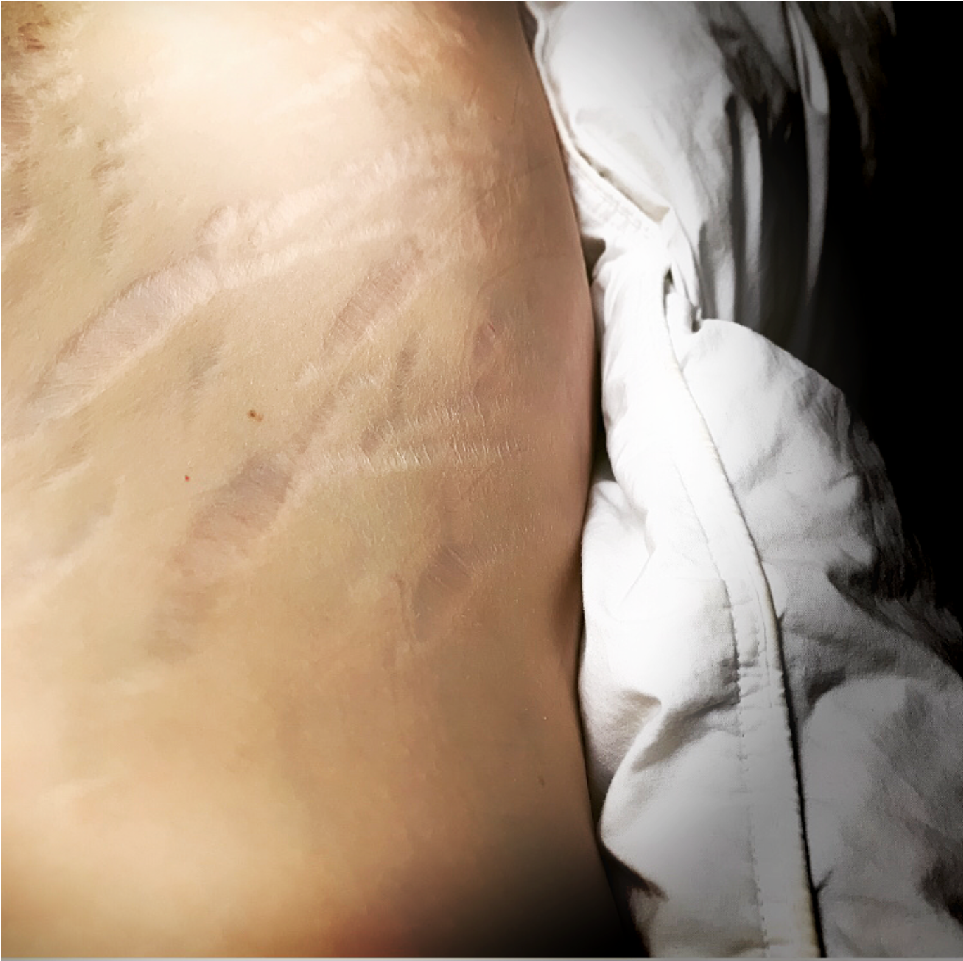These Are My Tiger Stripes I've Had Them Since I Had - Canyon (2278x2276), Png Download