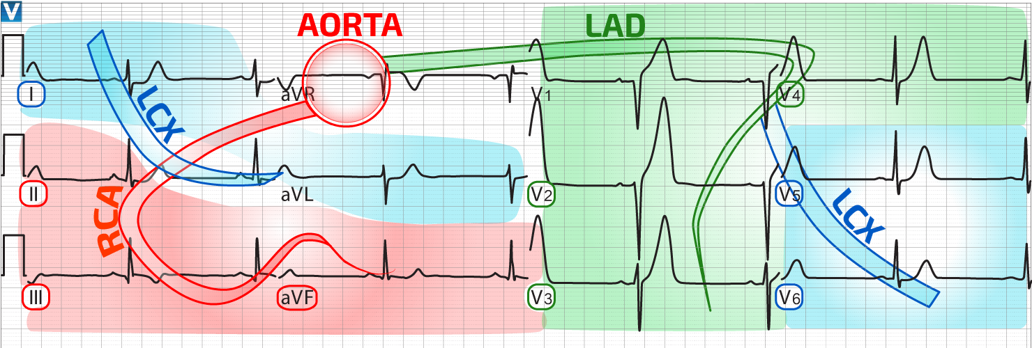 Distribution Of Coronary Perfusion And The Ecg - Ecg Coronary Arteries (1480x500), Png Download
