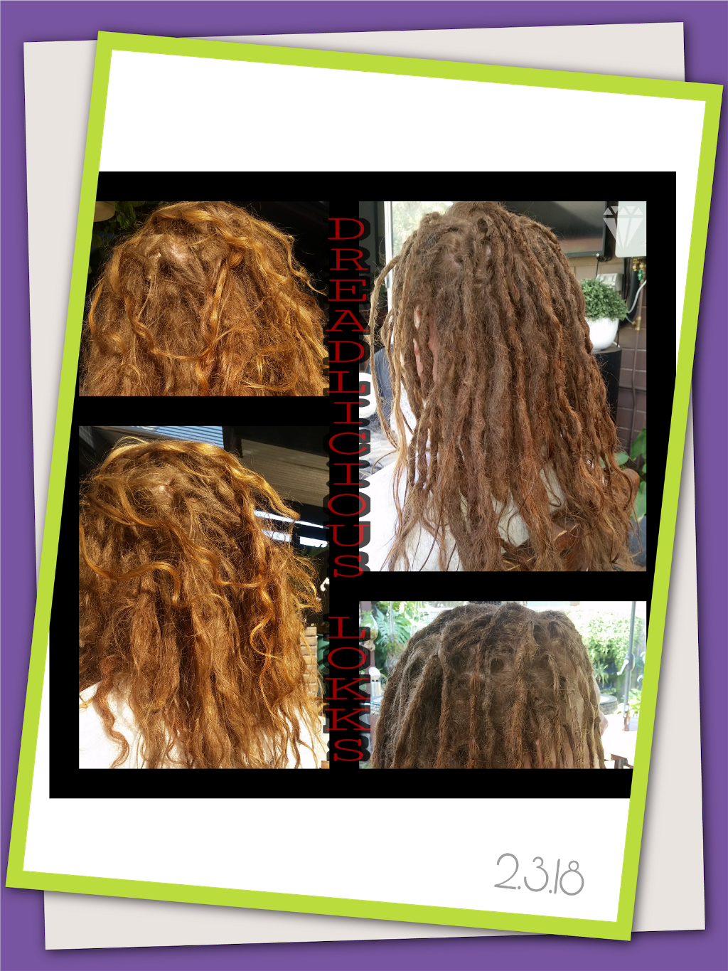 Report Abuse - Lace Wig (1024x1365), Png Download