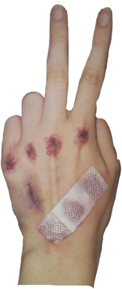 Bruise Art Fight Mood Freetoedit - Sign Language (240x570), Png Download