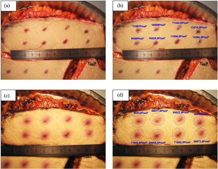 Measurement Of The Bruise Areas In The Control Group - Blood Bruise (902x547), Png Download