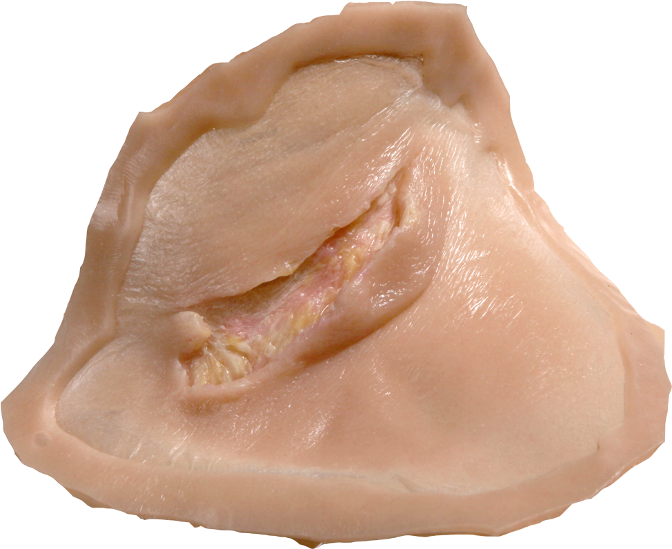 Drawing Blood Bruising - Scar (1000x1000), Png Download