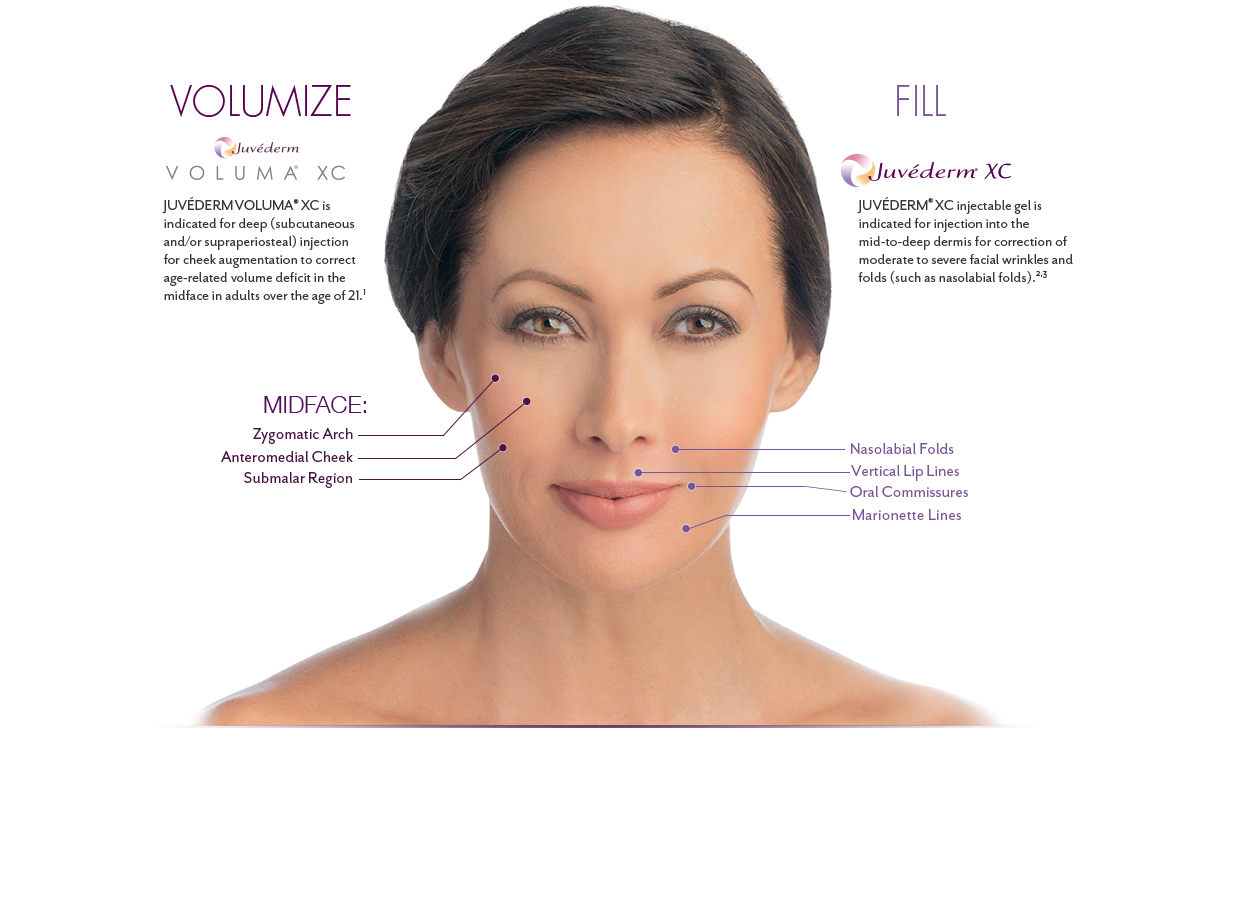 How Png Bruise Juvederm - Freckle (1244x910), Png Download