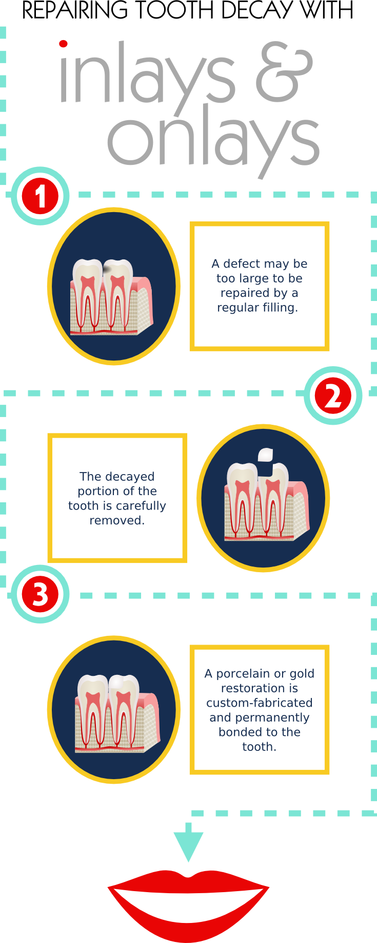 Inlay - Number (735x1836), Png Download