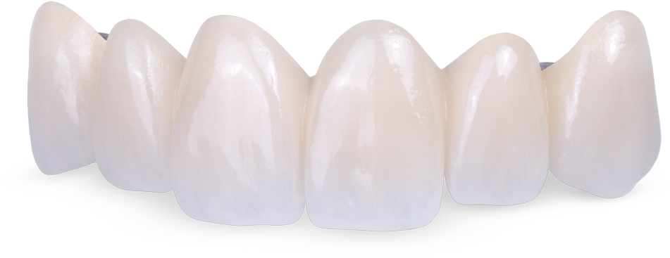 Fused To Metal - Oval (1200x476), Png Download