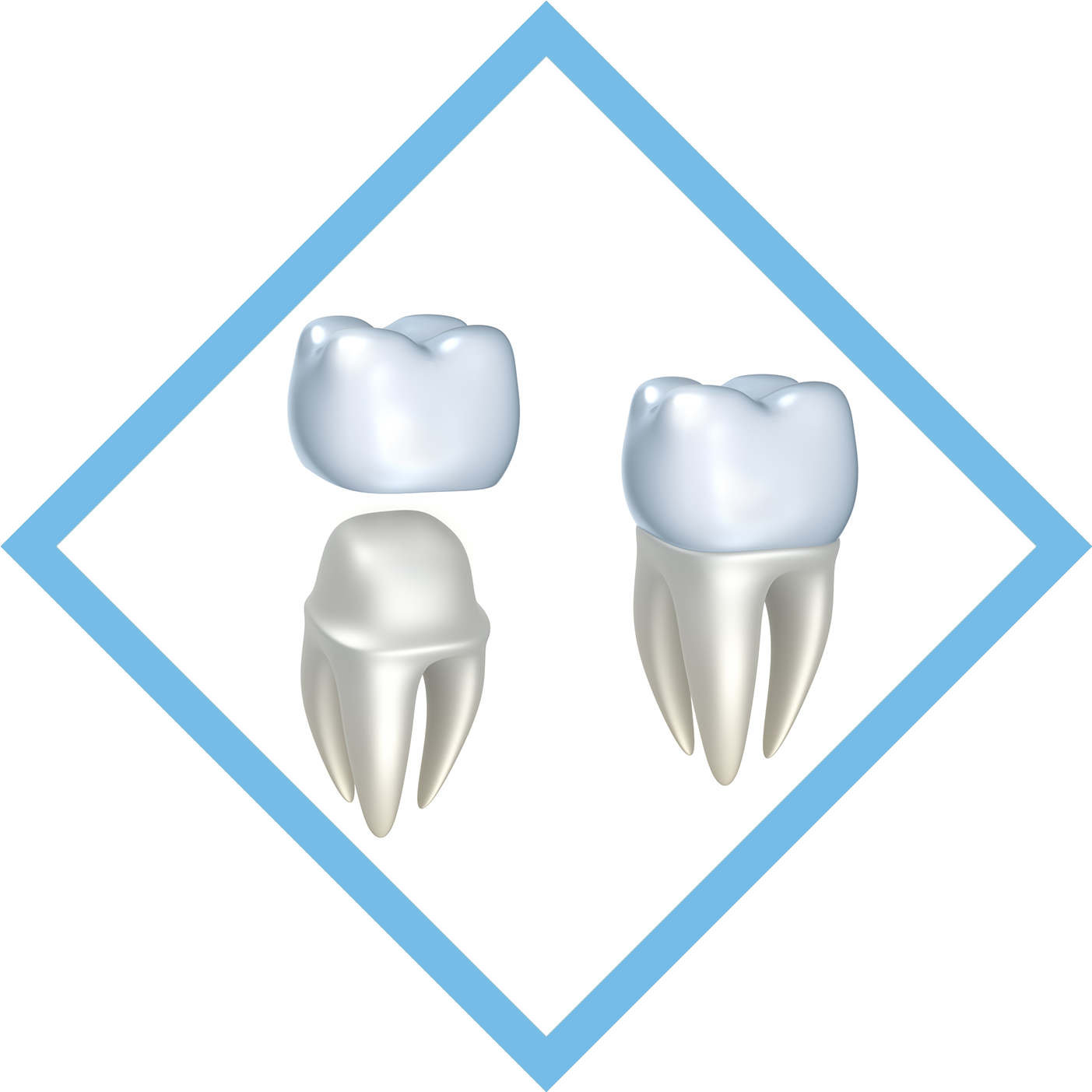 Ceramic Crown (1402x1412), Png Download