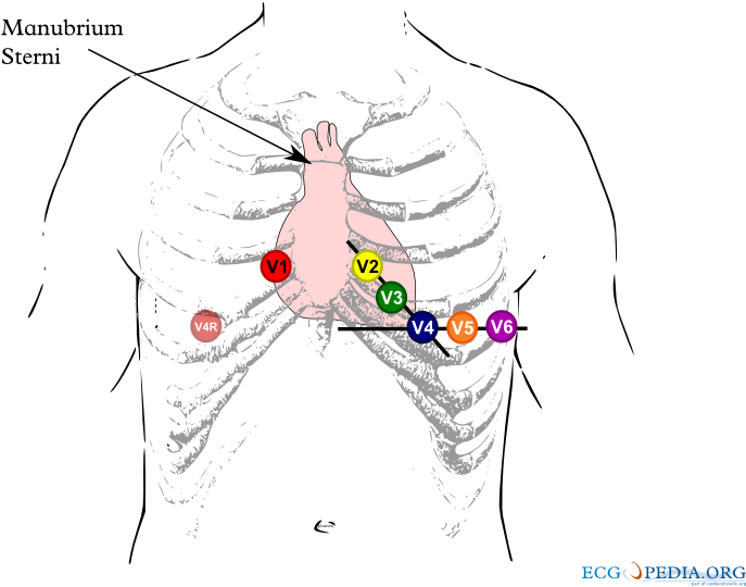 Chest Leads - 12 Afleidingen Ecg Plakken (800x600), Png Download
