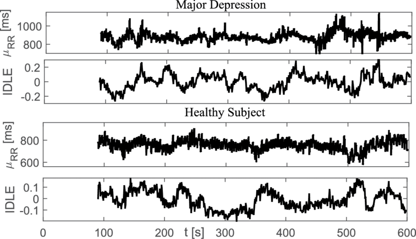 Instantaneous Heartbeat Statistics Computed From A - Sheet Music (850x489), Png Download