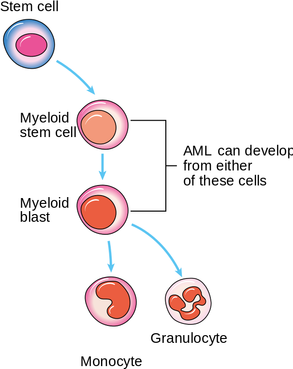 “diagram Showing The Cells In Which Aml Starts - Acute Myeloid Leukemia Diagram (606x768), Png Download