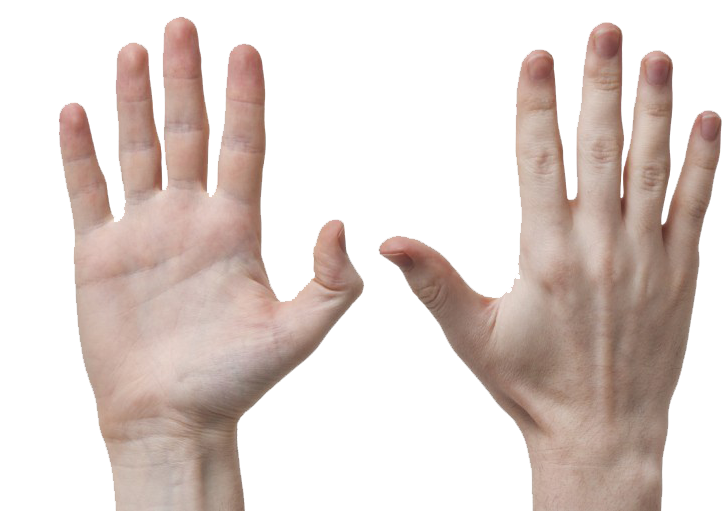 Fingers Png Background - Dupuytren's Contracture Of Thumb (782x521), Png Download