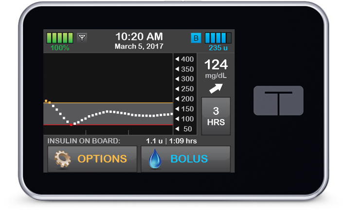 Although This Is Not Paid Content, Medtronic, Omnipod, - T Slim Insulin Pump (737x508), Png Download