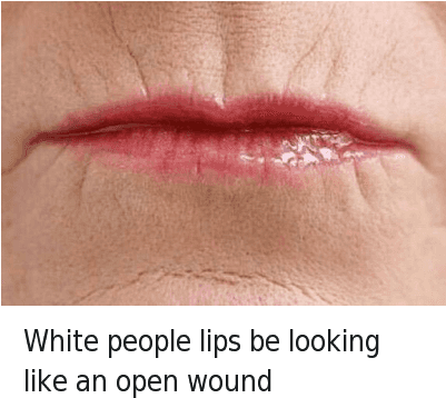 White People, White, And Ans - Lips That Look Like Open Wounds (400x371), Png Download