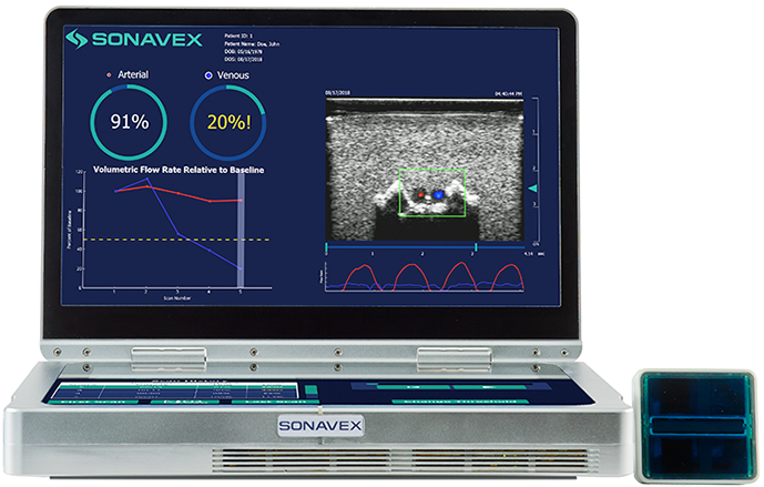 Download Sonavex Logo - Electronics (792x442), Png Download